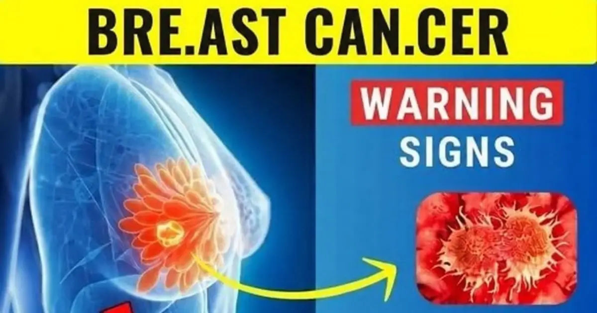 10 Warning Signs of Bre.ast Can.cer You MUST Know – Early Detection Saves Lives