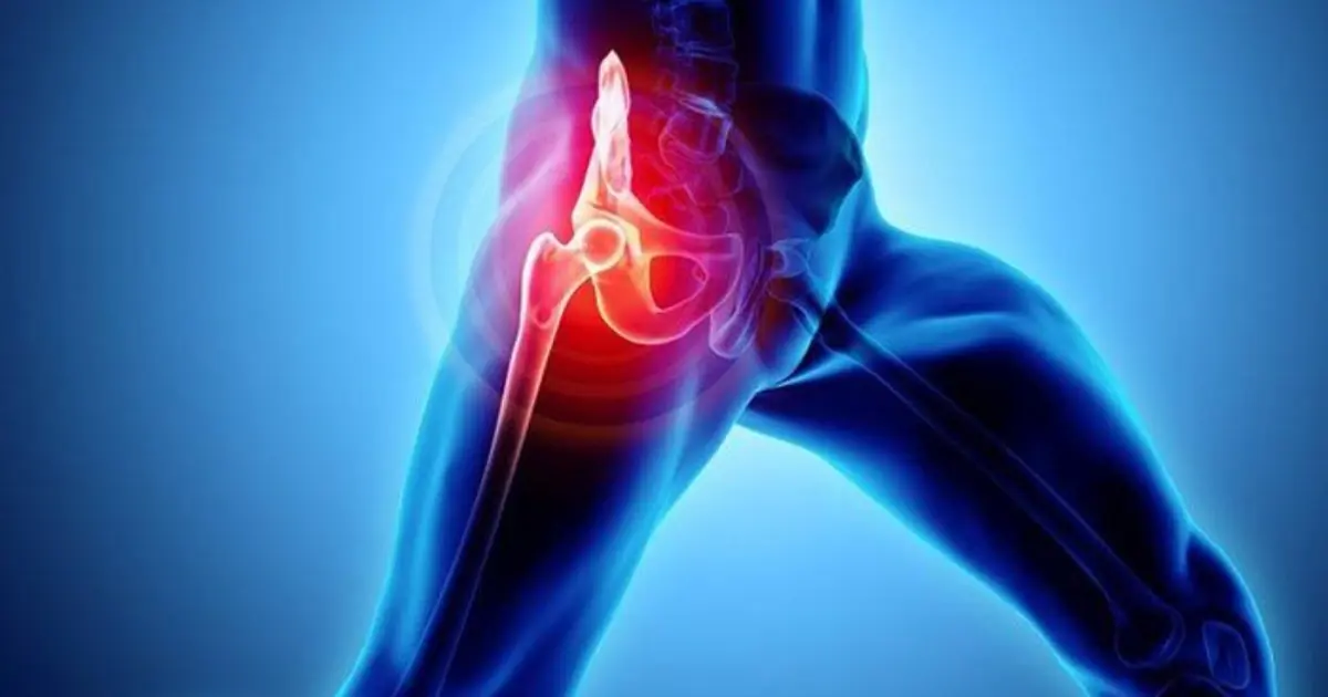 Hip Pain Shouldn’t Be Ignored: Common Causes and Tips for Relief