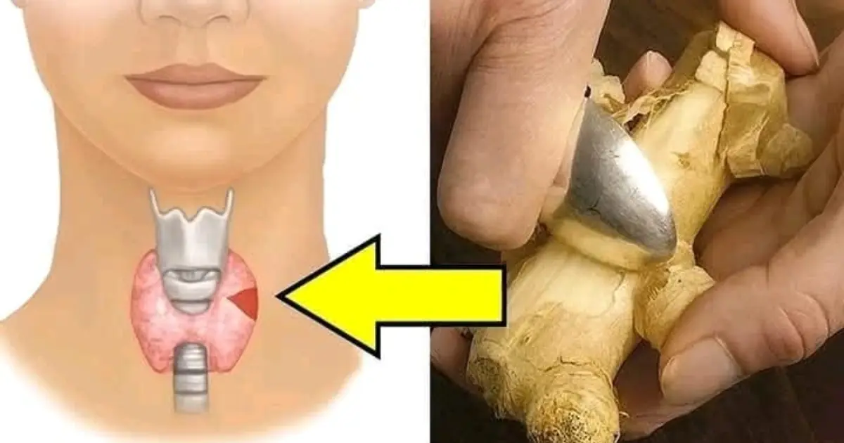 19 Foods to Avoid with Thyroid Problems