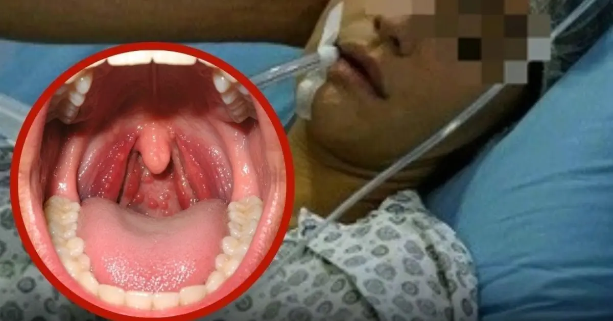 She Thought It Was Just A Sore Throat. Five Days Later, She Was D.ead
