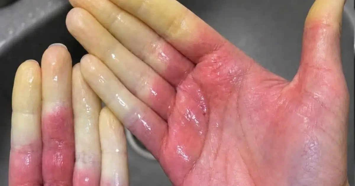 These are the consequences of sleeping with the…See more