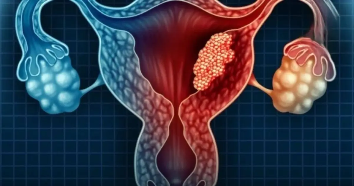 3 Intimate Habits of Husbands That May Increase Wives’ Risk of Cervical Can.cer