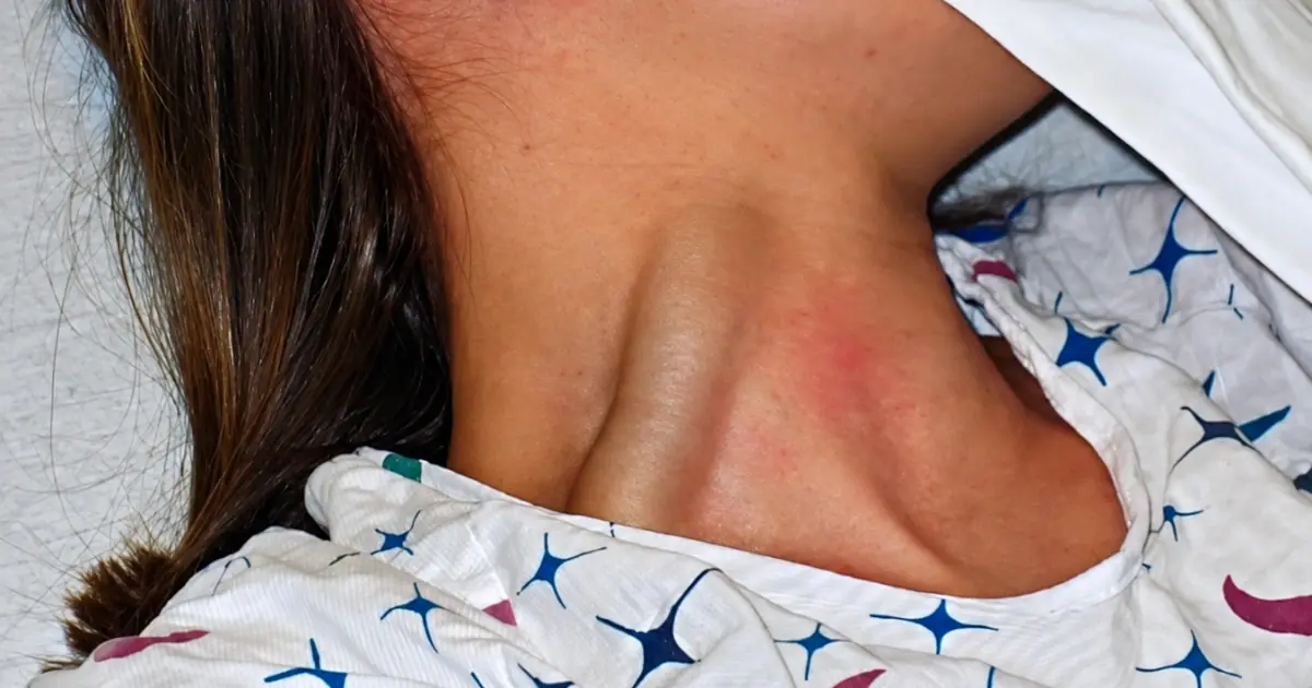 Prominent Neck Veins: A Warning Sign You Should Never Ignore