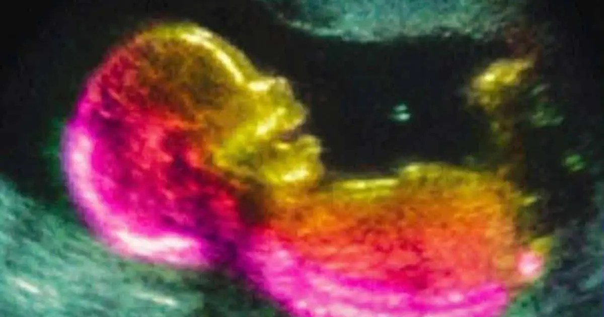 Scientists May Have Actually Found One Of The Causes Of Autism