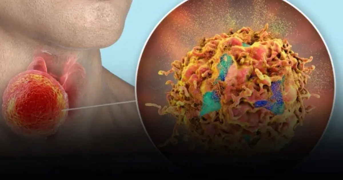 Constant Mucus in Your Throat? Here’s What Your Body May Be Trying to Tell You