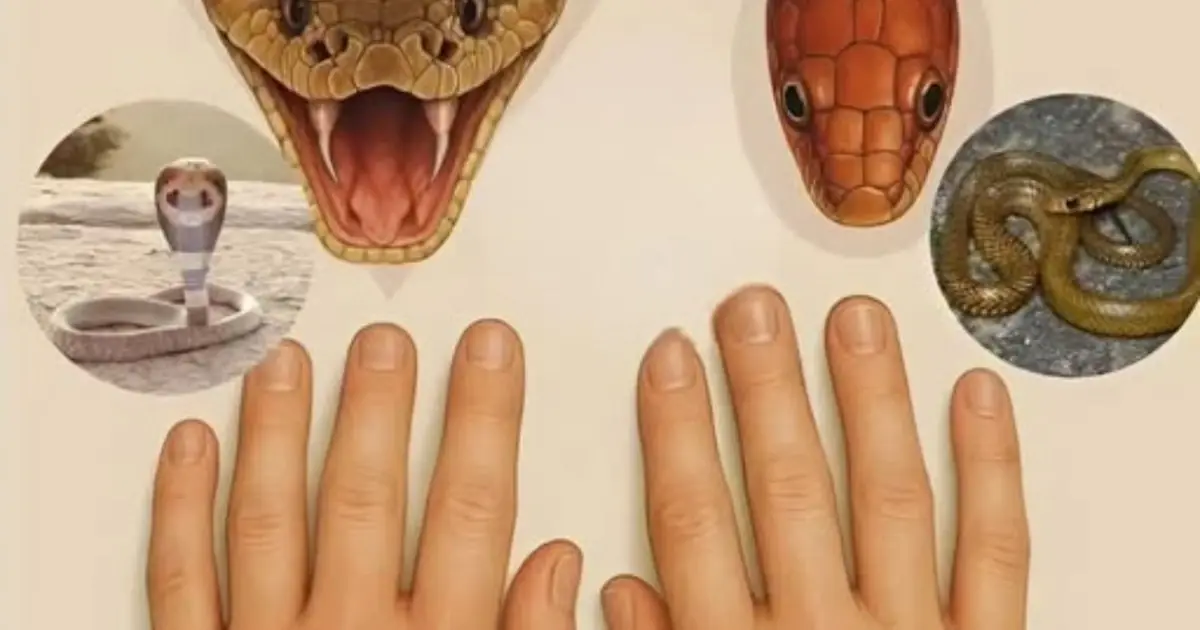 Snake bi.te - don't panic, do the following