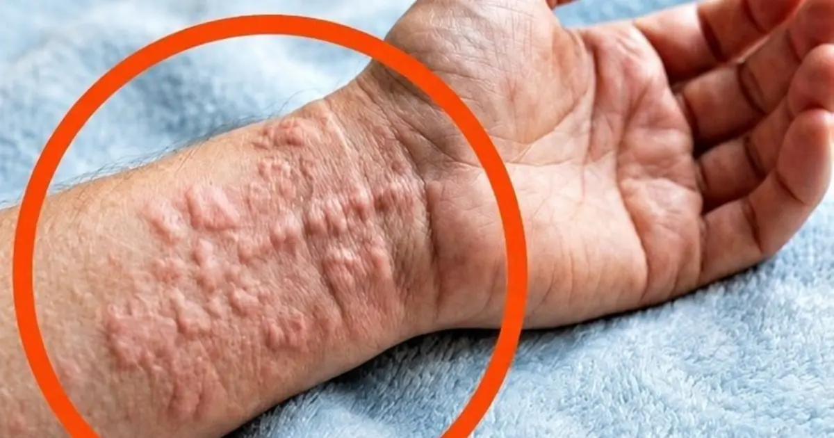 These are the consequences of sleeping with a... See more