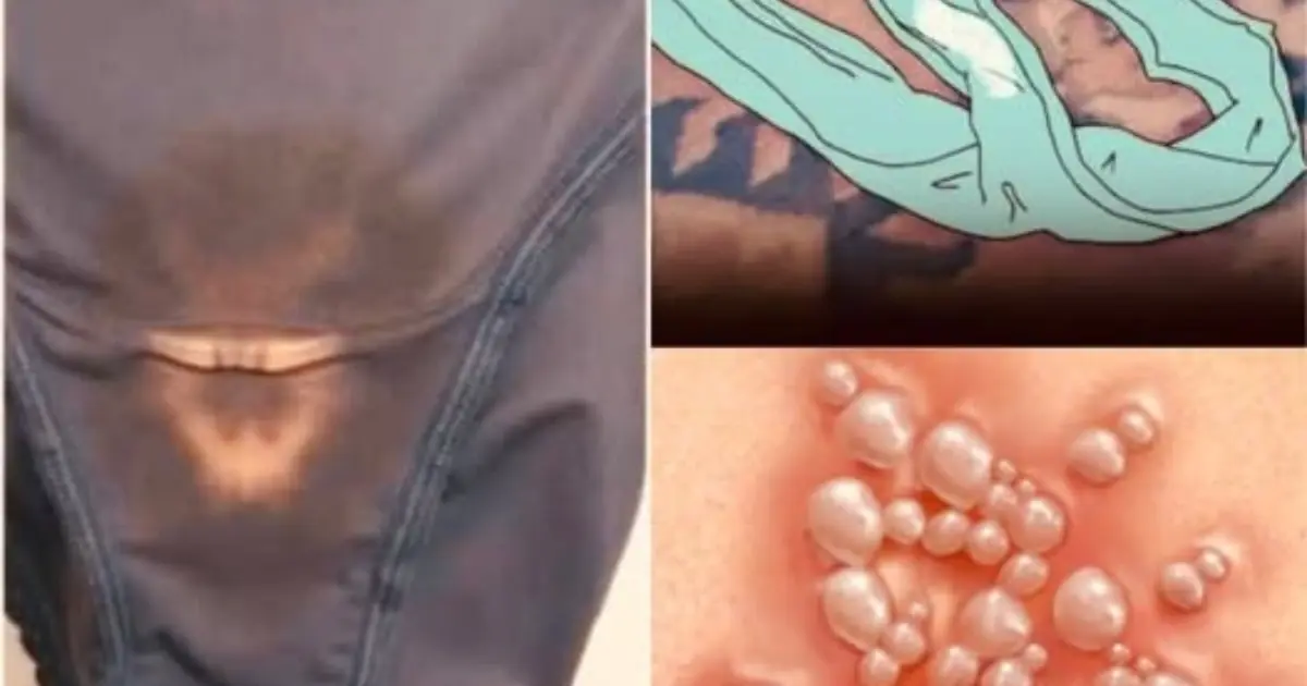 That Unusual Stain Isn’t Always Normal: What Vaginal Discharge May Be Telling You
