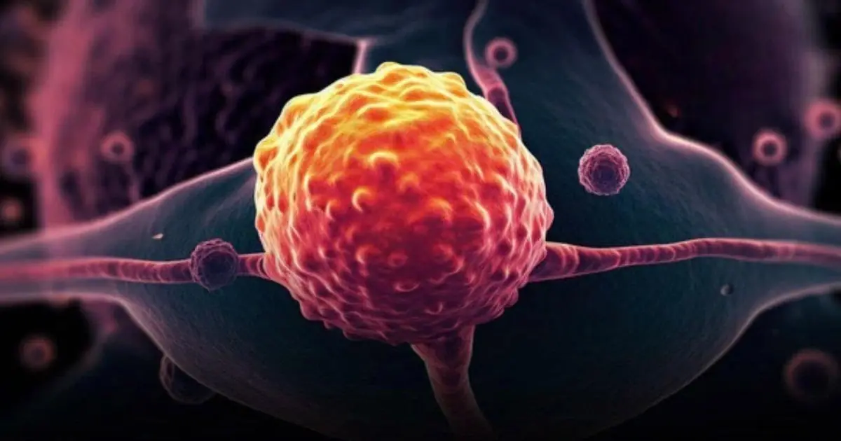 Hot Dogs and Processed Meats May Be the Most Dangerous Foods of All Time Because…