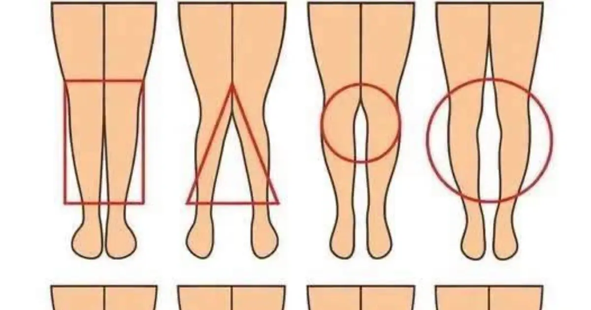 A WOMAN’S LEGS CAN TELL HOW HER IS...See More