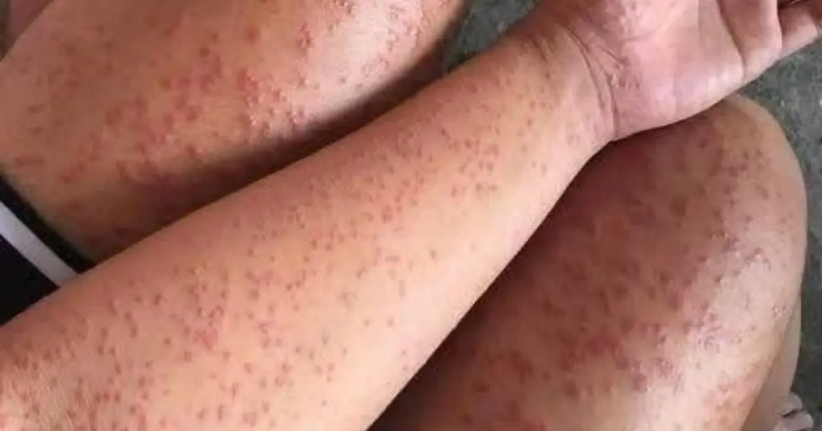 These are the consequences of sleeping with…