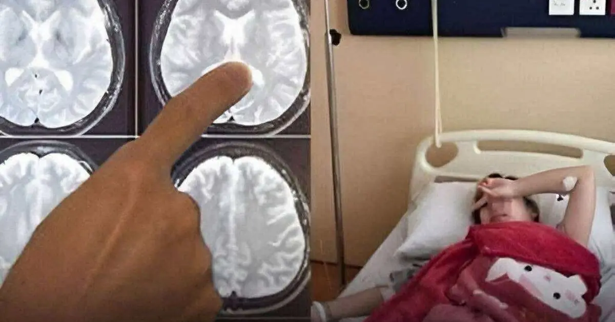 Stroke in Young Adults: Warning Signs You Should Never Ignore