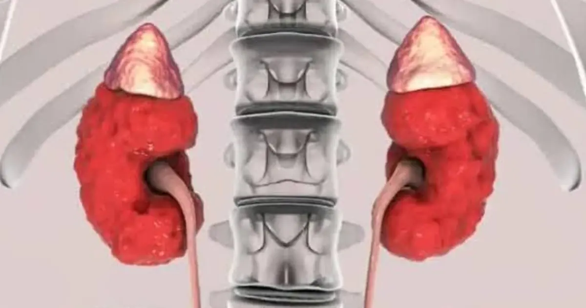 Your Kidneys May Be Sending These 23 Warning Signs