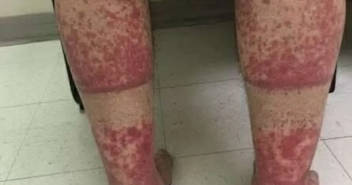 These are the consequences of sleeping with...