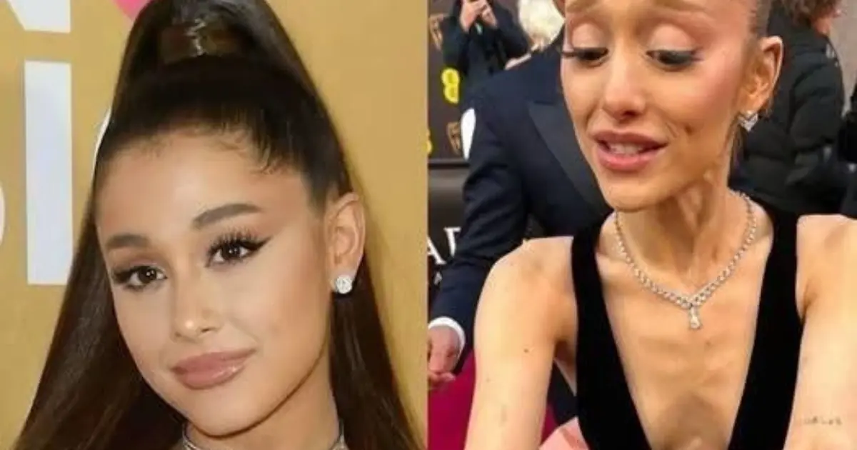 Breaking- Ariana Grande Confirms She Has Tested Positive for…See more ♪